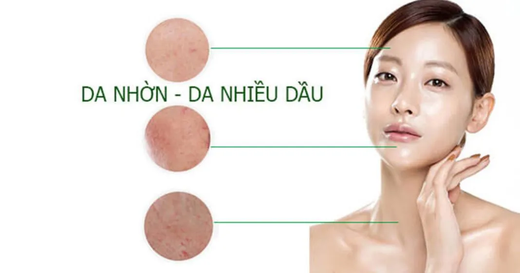 Cách trị nhờn da mặt tại nhà hiệu quả cho chị em mùa nắng nóng