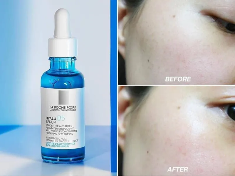 Review serum B5 La Roche-Posay cho da cần phục hồi