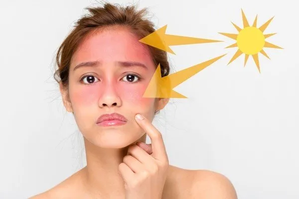 Tretinoin là gì? Tretinoin có thật sự hiệu quả như lời đồn?