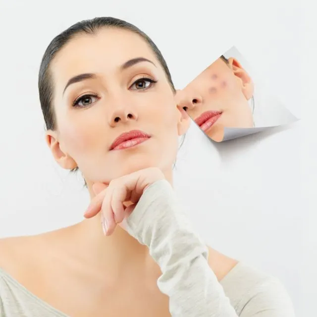 Xà phòng rửa mặt trị mụn – Xu hướng mới cho việc chăm sóc da
